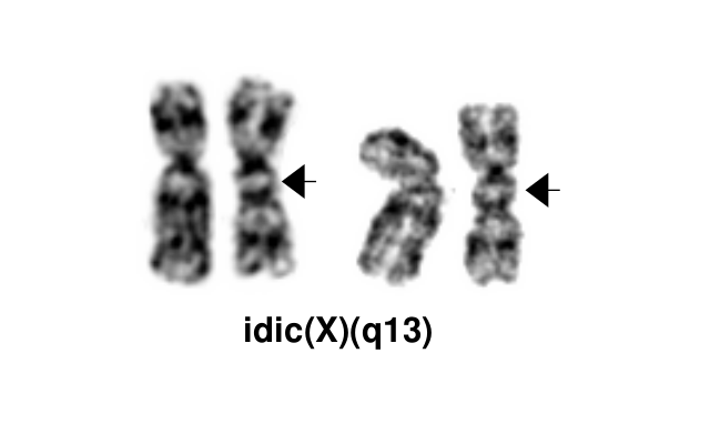 idic(X)(q13)